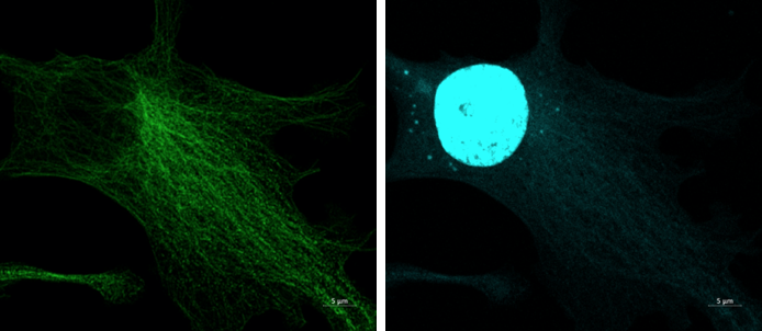 Microtubules apearing in DAPI channel